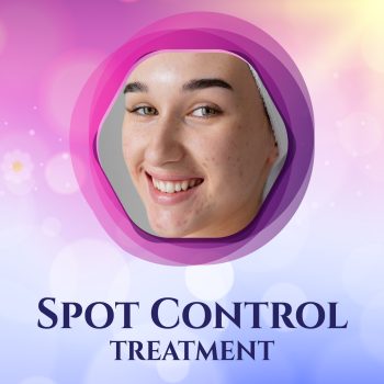 SPOT CONTROL