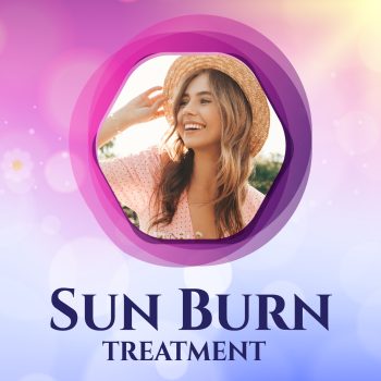 SUN BURN